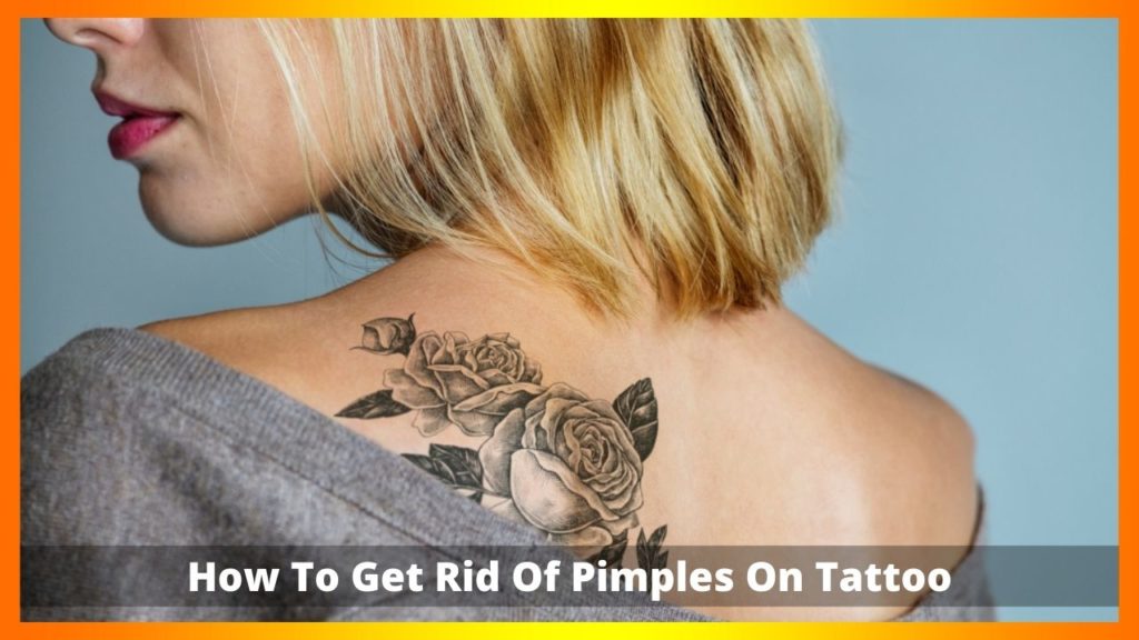 How To Get Rid Of Pimples On Tattoo