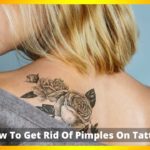 How-To-Get-Rid-Of-Pimples-On-Tattoo