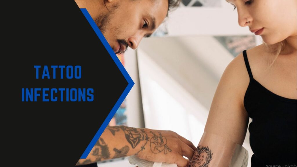 Tattoo Infections