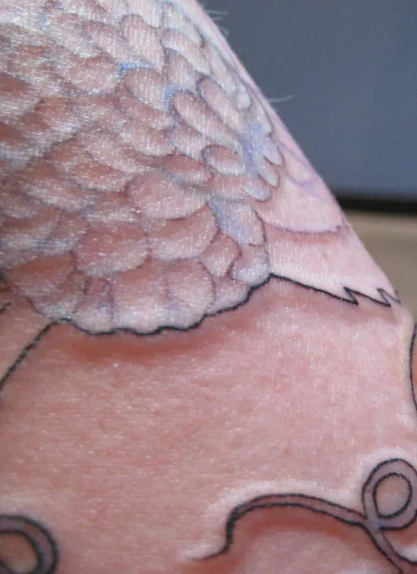 How To fix A Raised Tattoo