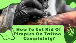 How To Get Rid Of Pimples On Tattoo Completely