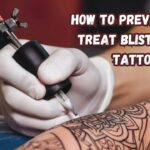 How to Prevent and Treat Blisters on Tattoo