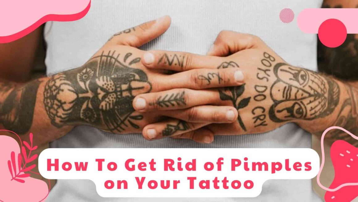 How To Get Rid of Pimples on Your Tattoo